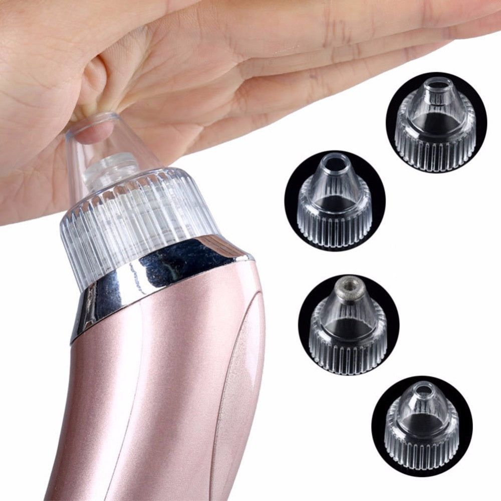 electriccal
al
cal
al
 small handhold
 Dead Skin Acne Vacuum Suction Blackhead Removal Face Lifting Skin screw up
 Rejuvenation Beauty Machine
